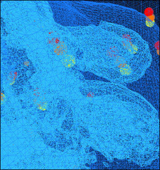 Computerized image showing wireframe representation of a fibroblast. Computerized image showing wireframe representation of a fibroblast.