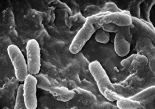 Black and white micrograph of P. aeruginosa. Black and white micrograph of P. aeruginosa.
