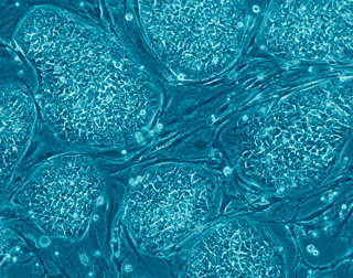 Photo of human embryonic stem cells stained blue Photo of human embryonic stem cells stained blue