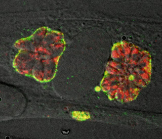 Infected cells viewed under a microscope, shown as amorphous blobs colored bright red, yellow, and green. Infected cells viewed under a microscope, shown as amorphous blobs colored bright red, yellow, and green.