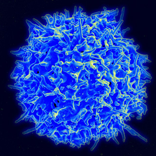 A scanning electron micrograph of a human T cell. The cell appears as a a blue sphere with irregularly shaped points protruding from it. A scanning electron micrograph of a human T cell. The cell appears as a a blue sphere with irregularly shaped points protruding from it.