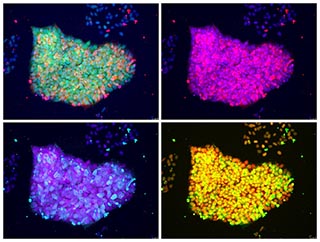Four different views of a collection of cells, shown in four different fluorescent colors. Clockwise from upper left, they are: green, pink, purple, and yellow. Four different views of a collection of cells, shown in four different fluorescent colors. Clockwise from upper left, they are: green, pink, purple, and yellow.