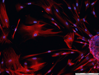 Neural progenitor cells shown as circular nuclei stained in blue, inside long lines of proteins stained in red. Neural progenitor cells shown as circular nuclei stained in blue, inside long lines of proteins stained in red.
