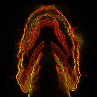 Photograph of a three-day-old zebrafish jaw, with glycan patterns labeled in fluorescent red, green, and yellow. Photograph of a three-day-old zebrafish jaw, with glycan patterns labeled in fluorescent red, green, and yellow.