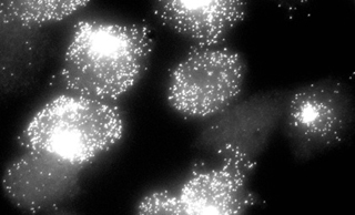Fluorescence micrograph of isogenic cells Fluorescence micrograph of isogenic cells