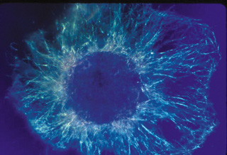 a photograph showing a cell dividing. a photograph showing a cell dividing.