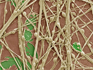 Nerve cells grown in culture as seen under a microscope. Nerve cells appear as tan threads on a brown background. Round tan beads on these threads are the synapses, the connections between nerve cells. Nerve cells grown in culture as seen under a microscope. Nerve cells appear as tan threads on a brown background. Round tan beads on these threads are the synapses, the connections between nerve cells.