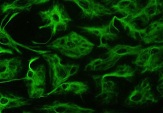 Visualization of astrocytes using GFAP. Visualization of astrocytes using GFAP.