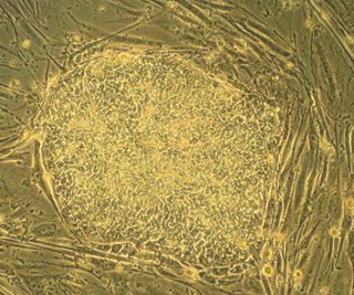 Embryonic stem cells from the H9 cell line. Embryonic stem cells from the H9 cell line.