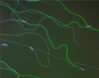 Fruit fly sperm cells shown as long fluorescent green squiggly lines. Fruit fly sperm cells shown as long fluorescent green squiggly lines.