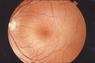 An image of a human retina An image of a human retina