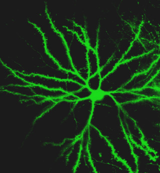 Bright fluorescent green jagged lines branching off of a central point. Bright fluorescent green jagged lines branching off of a central point.