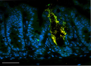 A micrograph of pathogenic bacteria (shown as yellow and green dots) attached to the lining of the intestine (shown as oval-shaped cells stained blue). A micrograph of pathogenic bacteria (shown as yellow and green dots) attached to the lining of the intestine (shown as oval-shaped cells stained blue).