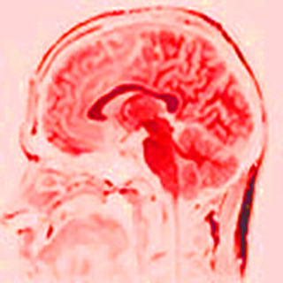 A red tinted MRI of an adult human brain. A red tinted MRI of an adult human brain.