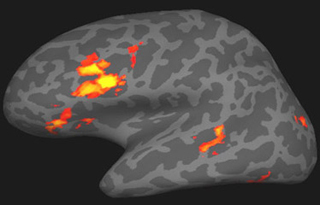 Representation of a brain during memory aquisition task, showing the associated areas that are employed during the task in different colors. Representation of a brain during memory aquisition task, showing the associated areas that are employed during the task in different colors.