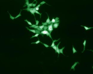 Green fluorescent neuronal cells. Green fluorescent neuronal cells.