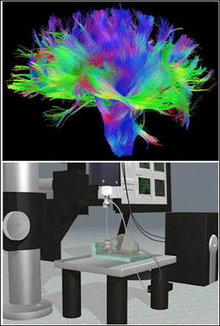 Top image is a colorful illustration of some of the connections in the human brain, while the bottom schematic shows the design of the Autopatcher apparatus. Top image is a colorful illustration of some of the connections in the human brain, while the bottom schematic shows the design of the Autopatcher apparatus.
