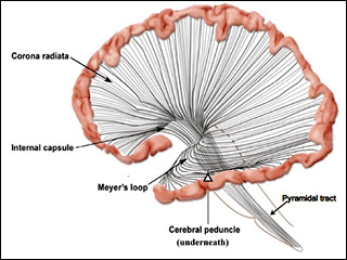 Drawing of the left hemisphere of the brain, including the outermost edge of the brain connected by radiations of axons to the brainstem and spinal cord. Drawing of the left hemisphere of the brain, including the outermost edge of the brain connected by radiations of axons to the brainstem and spinal cord.