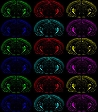 A multicolored montage of coronal sections of brains. A multicolored montage of coronal sections of brains.