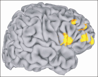 Image of the brain with key areas highlighted. Image of the brain with key areas highlighted.