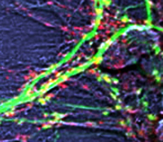 Neurons grown in culture and labeled to measure plasticity in a living system. Neurons grown in culture and labeled to measure plasticity in a living system.