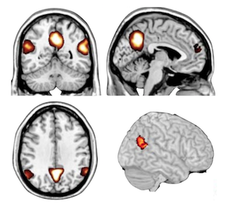 fMRI image of regions in the brain used in assessing intent. fMRI image of regions in the brain used in assessing intent.
