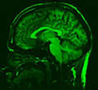 An image of a Midsaggital brain scan of a human. An image of a Midsaggital brain scan of a human.