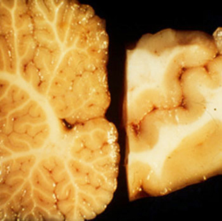 A side-by-side comparison of the cerebellar cortex and the neocortex. A side-by-side comparison of the cerebellar cortex and the neocortex.