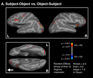 A graphic demonstrating BOLD signal activations in the brain. A graphic demonstrating BOLD signal activations in the brain.