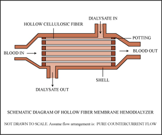 An illustration of a hollow fiber membrane hemodialyzer. The illustration calls out important features of the device as well as the indicating the flow of fluids. An illustration of a hollow fiber membrane hemodialyzer. The illustration calls out important features of the device as well as the indicating the flow of fluids.