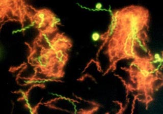 A false colored image of magnified bacteria. A false colored image of magnified bacteria.