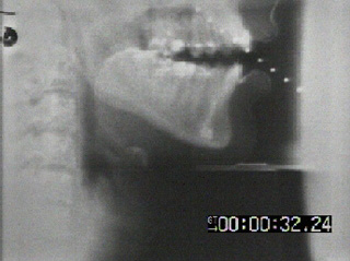 X-ray of person speaking. X-ray of person speaking.