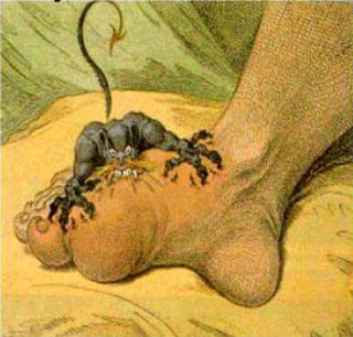 Illustration of Gout as a devil attacking a foot Illustration of Gout as a devil attacking a foot