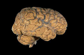 Photo of a human brain. Photo of a human brain.