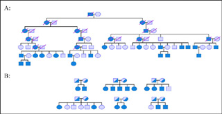 Pedigrees showing two approaches for collecting families for linkage analysis. Pedigrees showing two approaches for collecting families for linkage analysis.