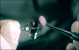 Photo of a tissue-engineered construct. Photo of a tissue-engineered construct.