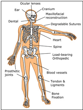 Diagram of the human body with locations for biomaterial applications. Diagram of the human body with locations for biomaterial applications.