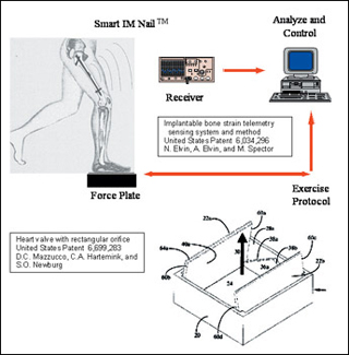 Diagram of bone strain system, showing implant in femur, standing on force plate, an exercise protocol, and receiver and analysis/control modules; and a patent diagram of the rectangular heart valve. Diagram of bone strain system, showing implant in femur, standing on force plate, an exercise protocol, and receiver and analysis/control modules; and a patent diagram of the rectangular heart valve.