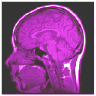 A brain scan image. A brain scan image.
